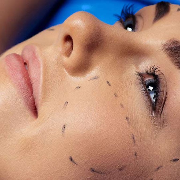 m 16 noiembrie 2021 Articole Intervențiile de medicină estetică